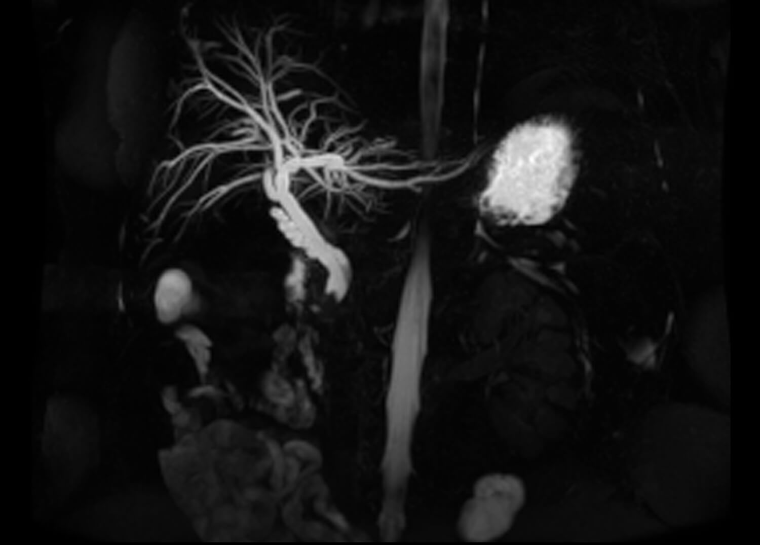 Body Imaging