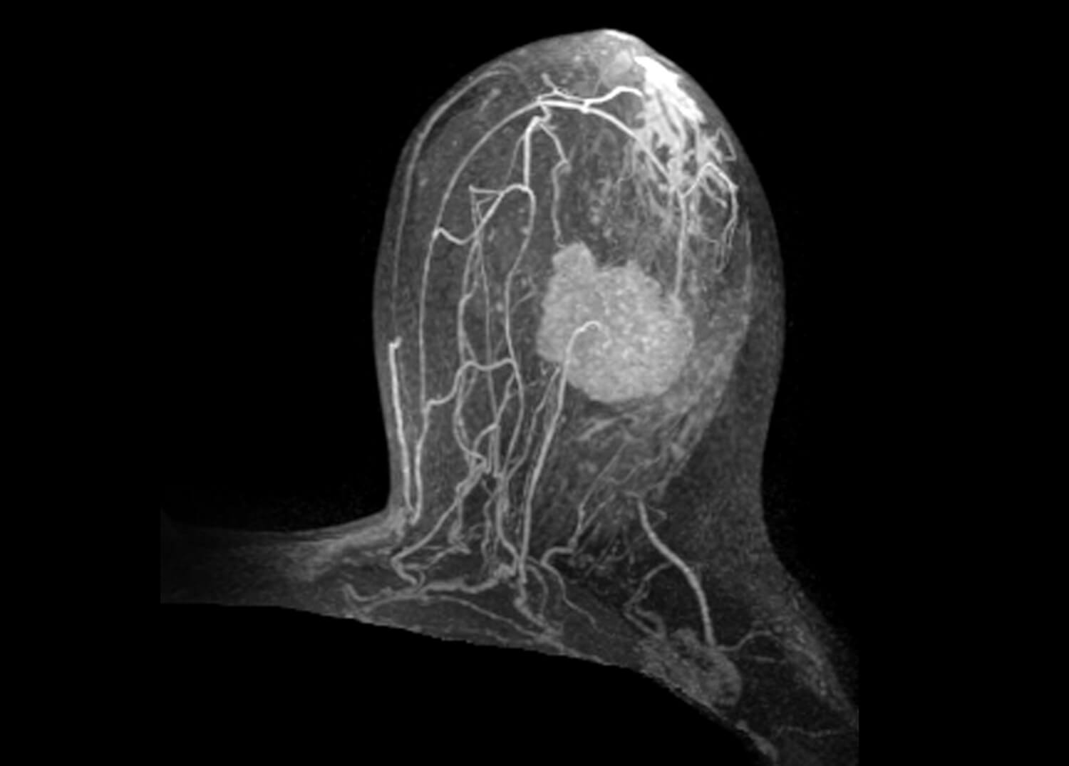 Breast Imaging
