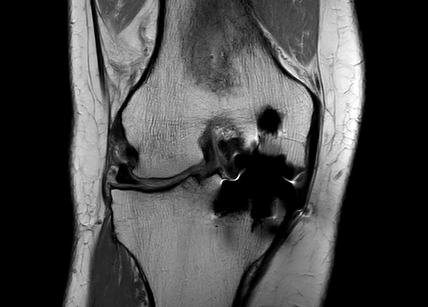 Ortho Imaging