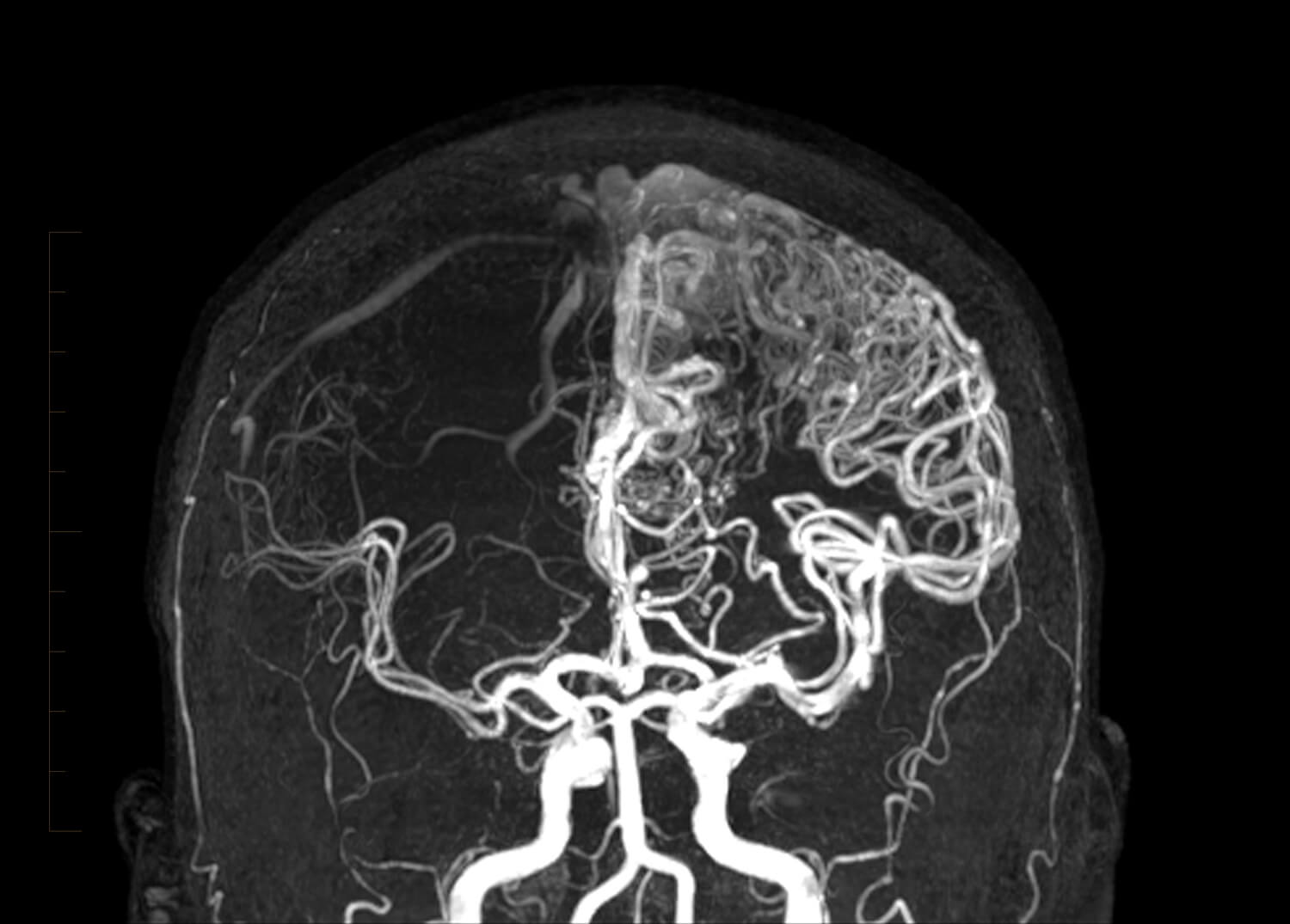 Vascular Imaging